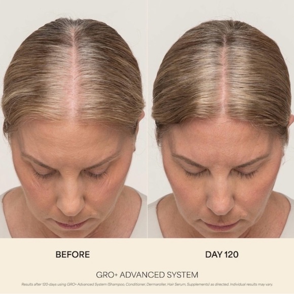 🎸Vegamour🎸🔥NWT🔥GRO+ Advanced Hair Serum for Severe Signs of Thinning-1 FI oz. - Picture 9 of 16